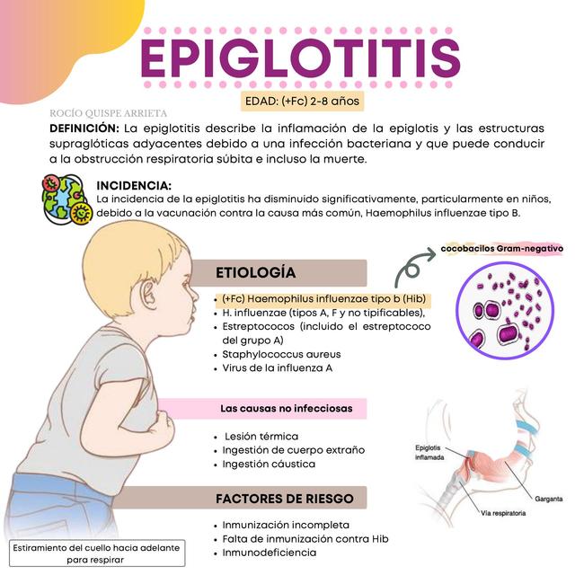 Epiglotis