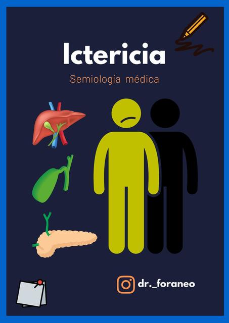 Ictericia