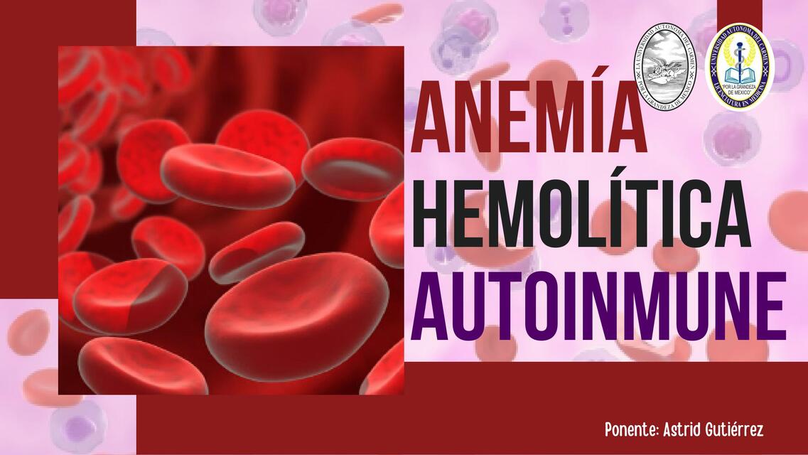 Anemia Hemolítica Autoinmune | Astrid Gutiérrez | uDocz