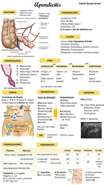 Apendicitis Aguda