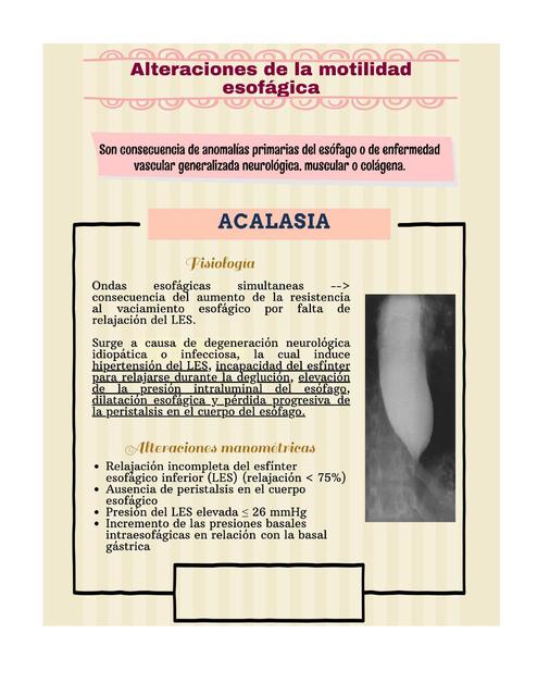 Alteraciones de la Motilidad Esofágica 