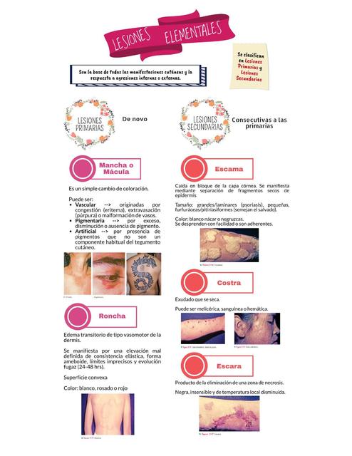 Lesiones Elementales