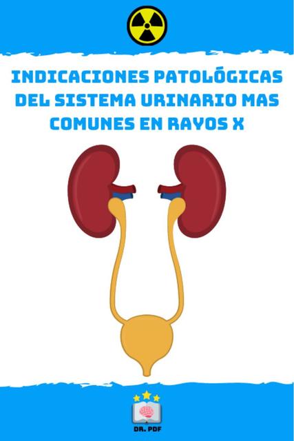 Indicaciones patológicas del sistema urinario mas comunes en rayos x