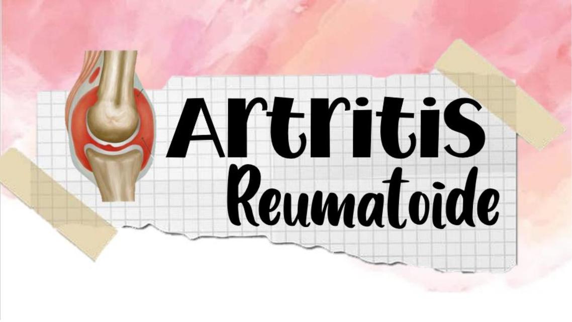 Artritis Reumatoide