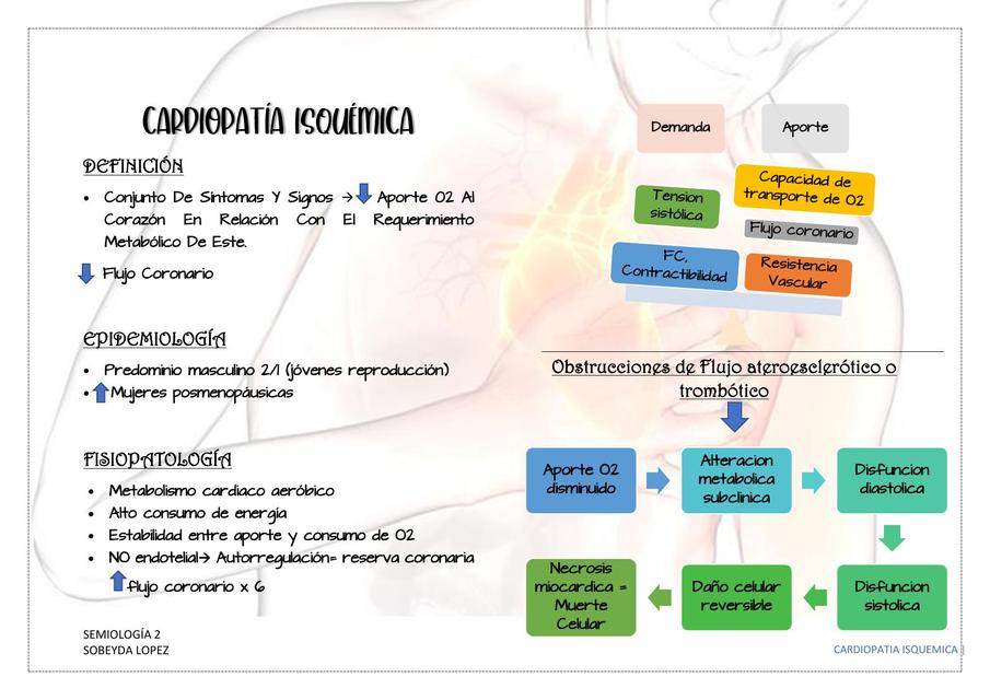 Cardiopatía Isquémica