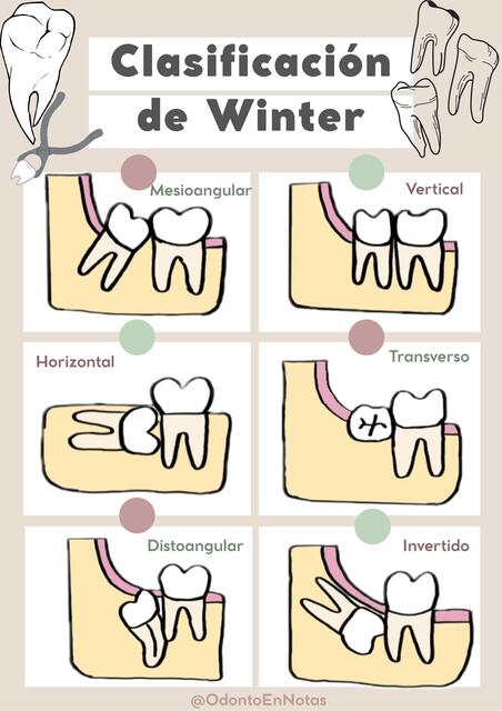 Clasificación de Winter | OdontoEnNotas | uDocz