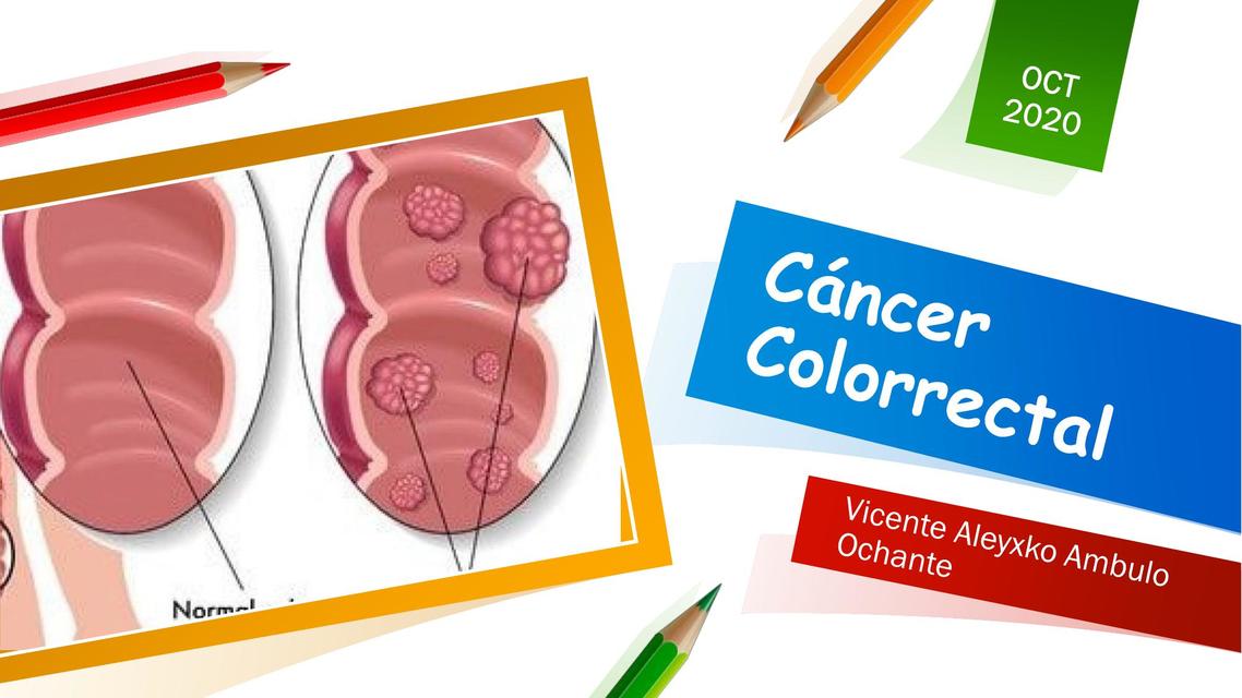 Cáncer Colorectal - Colon y Recto - Oncología Médica