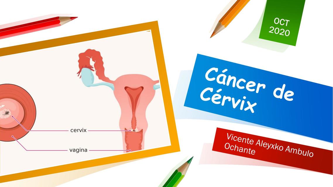 Cáncer de Cérvix - Oncología Médica