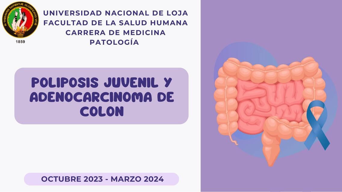 Flashcards de POLIPOSIS JUVENIL Y ADENOCARCINOMA DE COLON | Por Ana ...