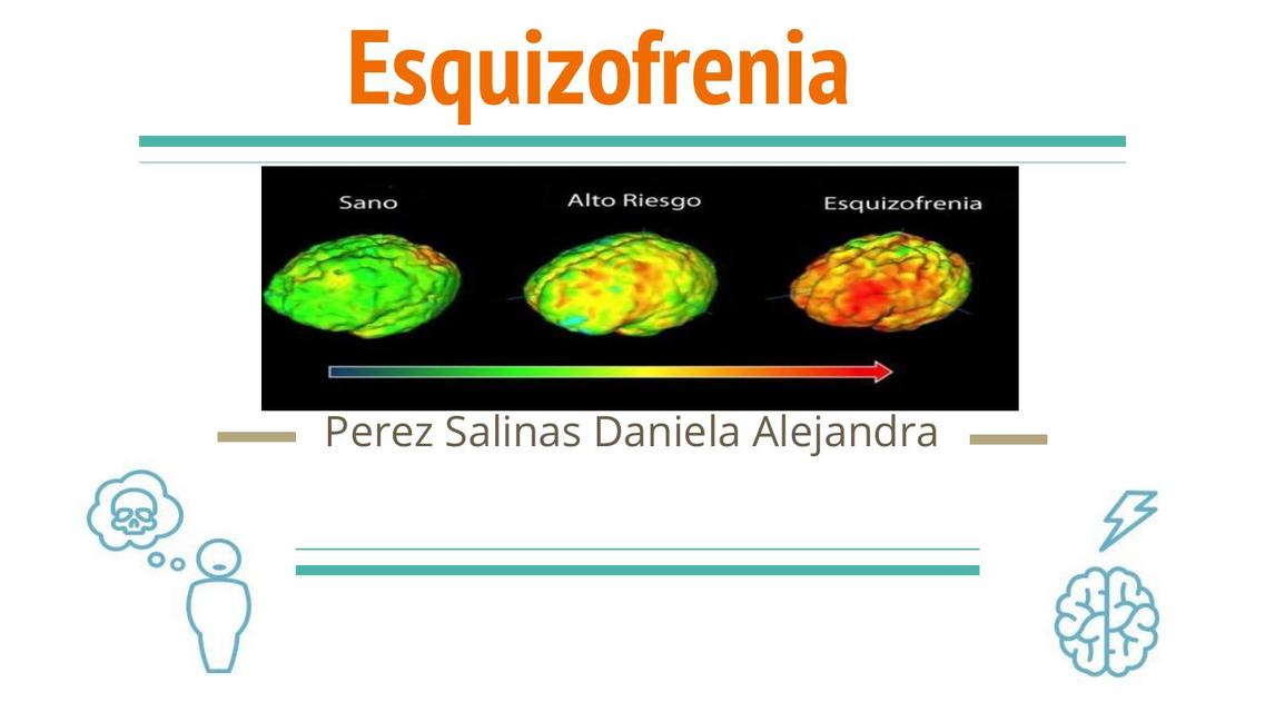 Esquizofrenia 