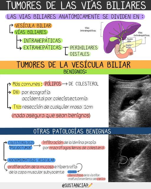 Tumores de la vesícula biliar 