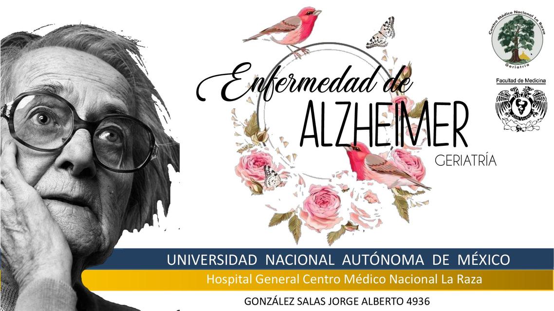 Enfermedad de Alzheimer