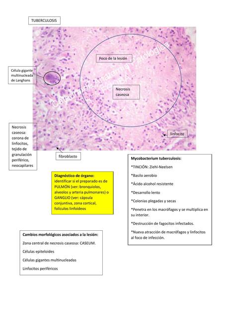 Tuberculosis actinomicosis candidiasis