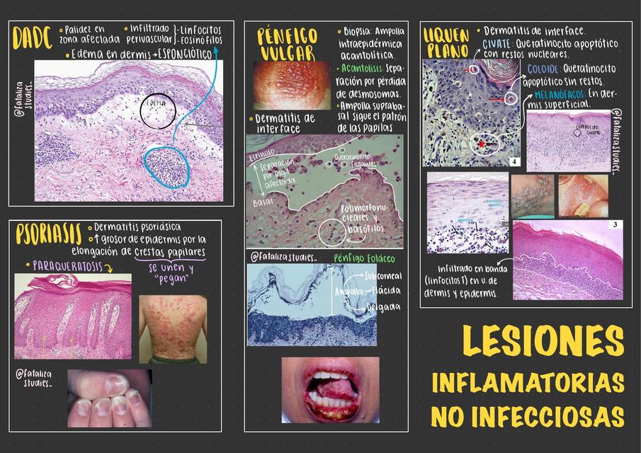 lesiones-inflamatorias-no-infecciosas-fataliza-udocz