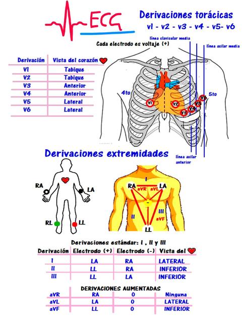 Colocaci n Est ndar De Ecg De 12 Derivaciones Electrocardiograma Colocaci n Est ndar De Ecg De 12 Derivaciones Electrocardiograma