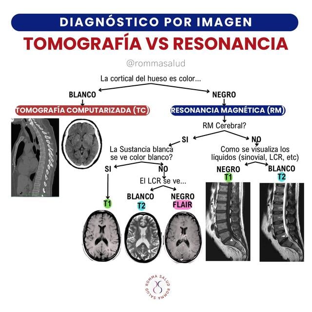 diferenciar-tc-de-rnm-romma-salud-udocz