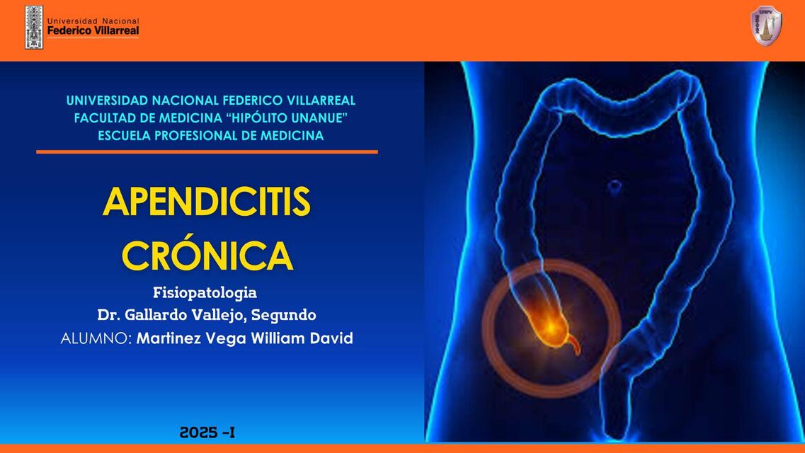 Apendicitis | William Martinez | uDocz