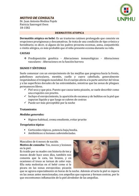 Dermatitis Atopica - Motivo de consulta