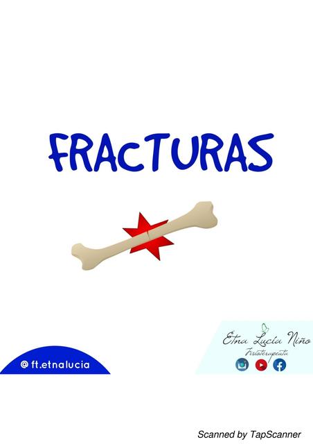 Fracturas 