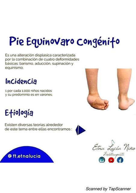 Pie Equinovaro