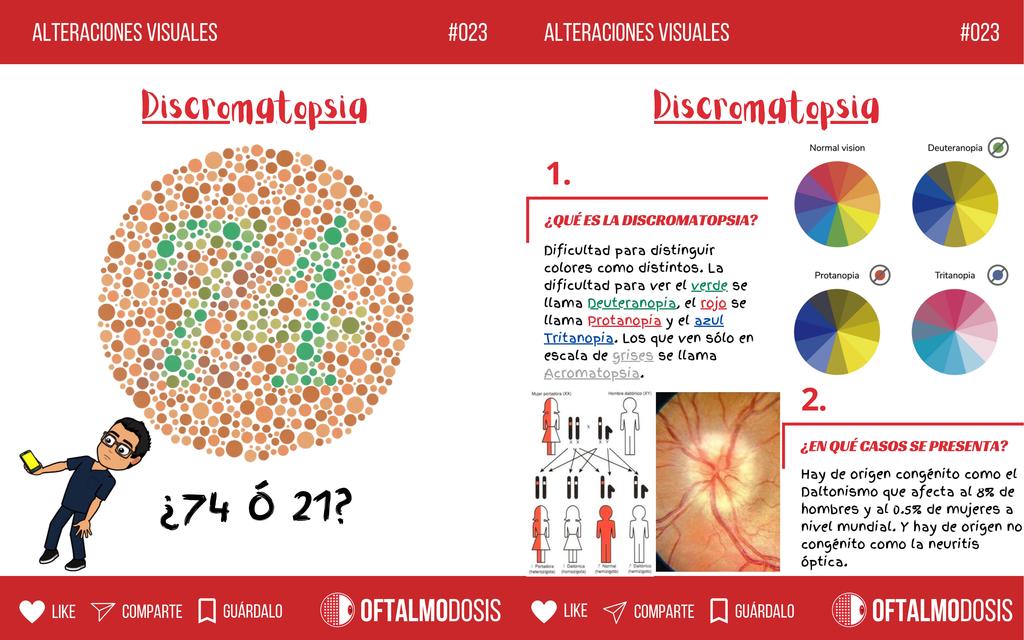 FLASHCARD de oftalmología 023 DISCROMATOPSIA