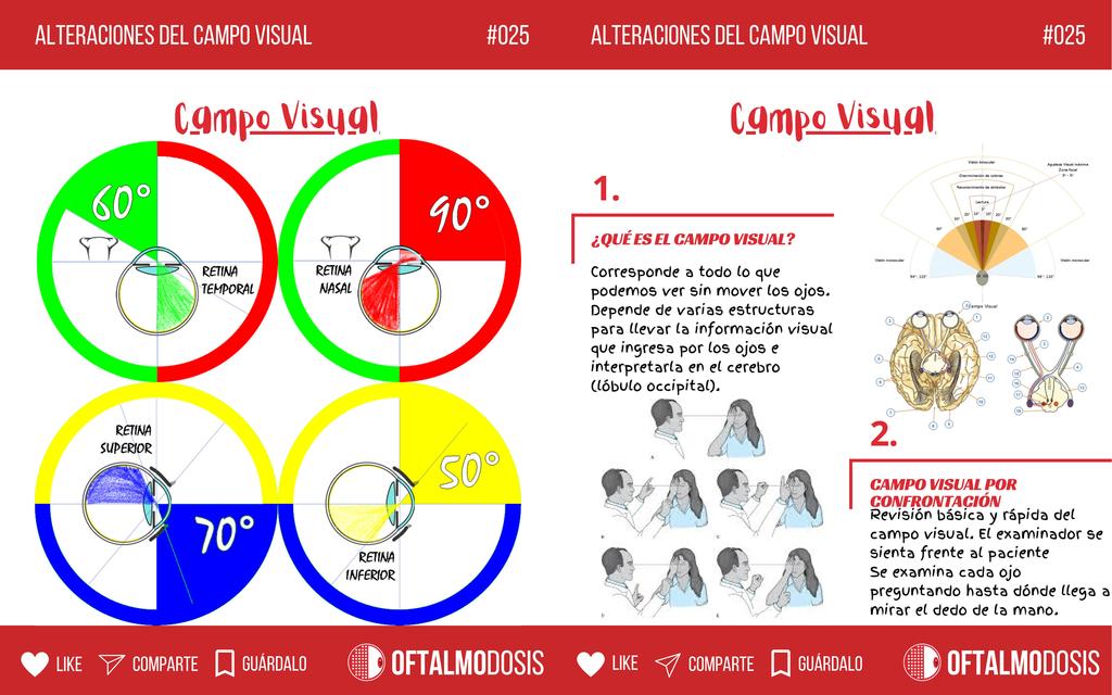 FLASHCARD de oftalmología 025 CAMPO VISUAL