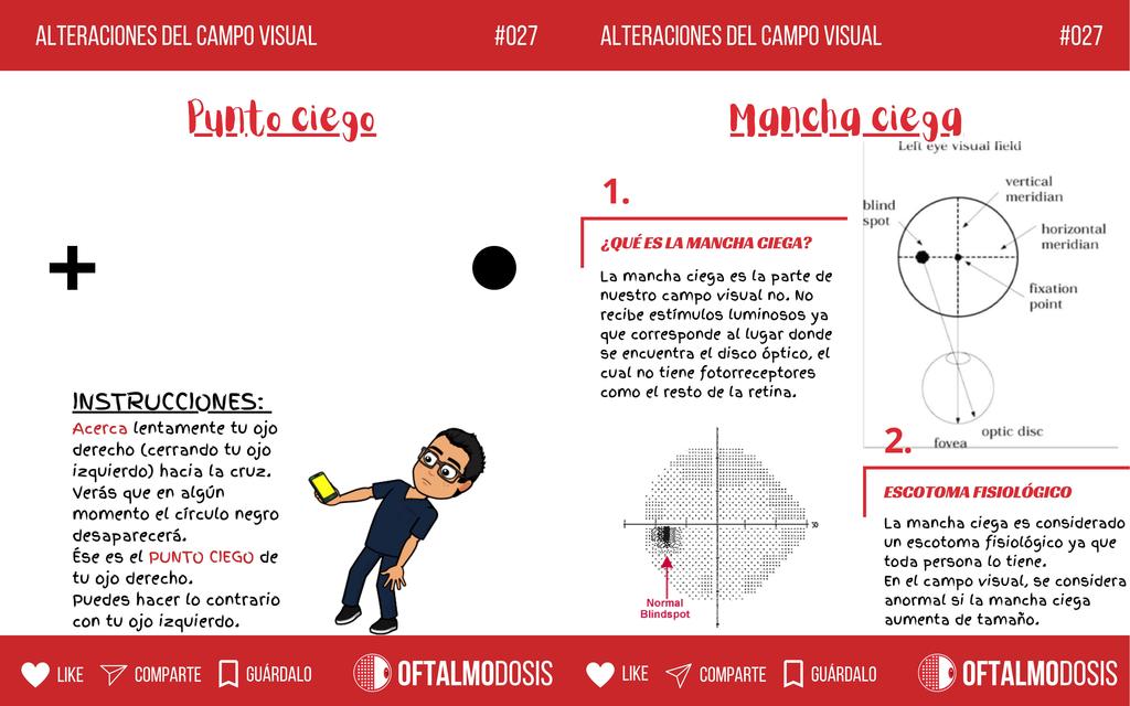 FLASHCARD de oftalmología 027 MANCHA CIEGA