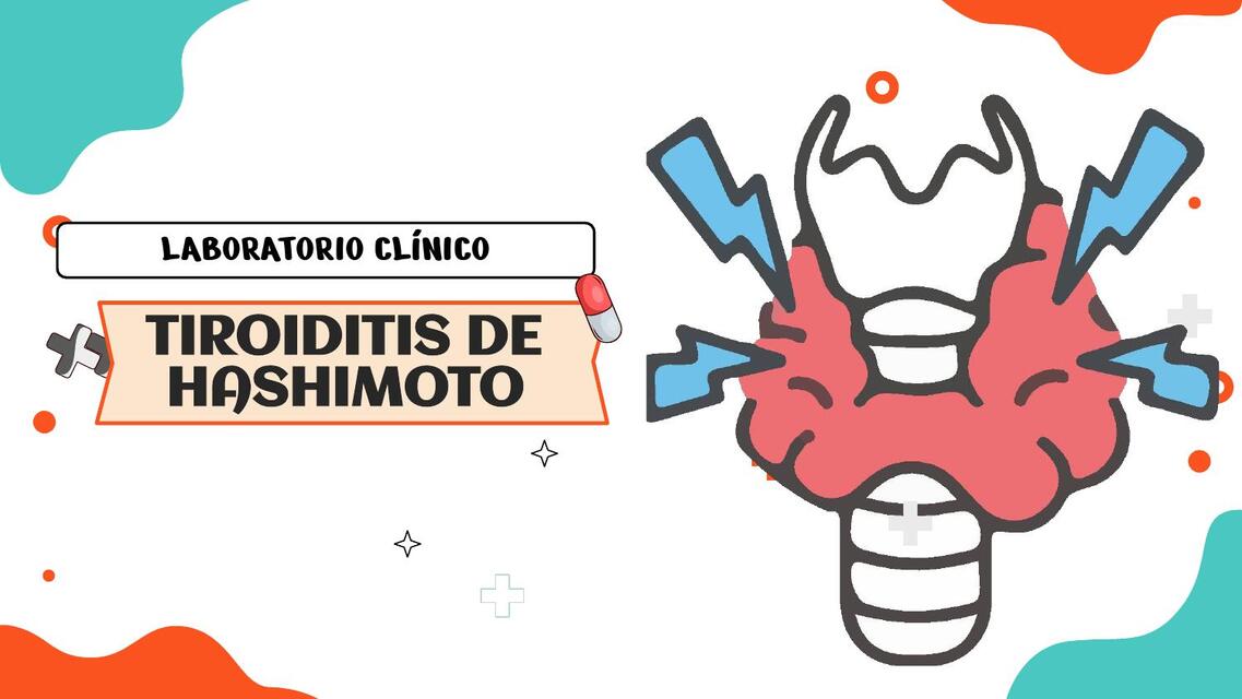 TIROIDITIS DE HASHIMOTO | katty Ramirez | uDocz