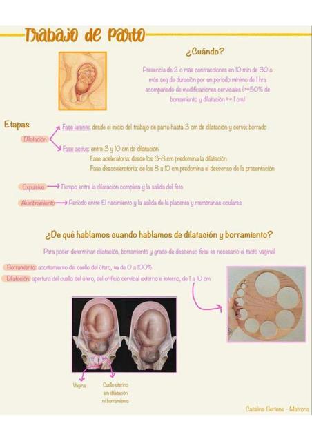 Trabajo de Parto