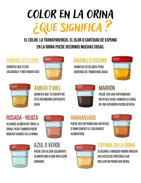 Color en la orina | Bruno | uDocz