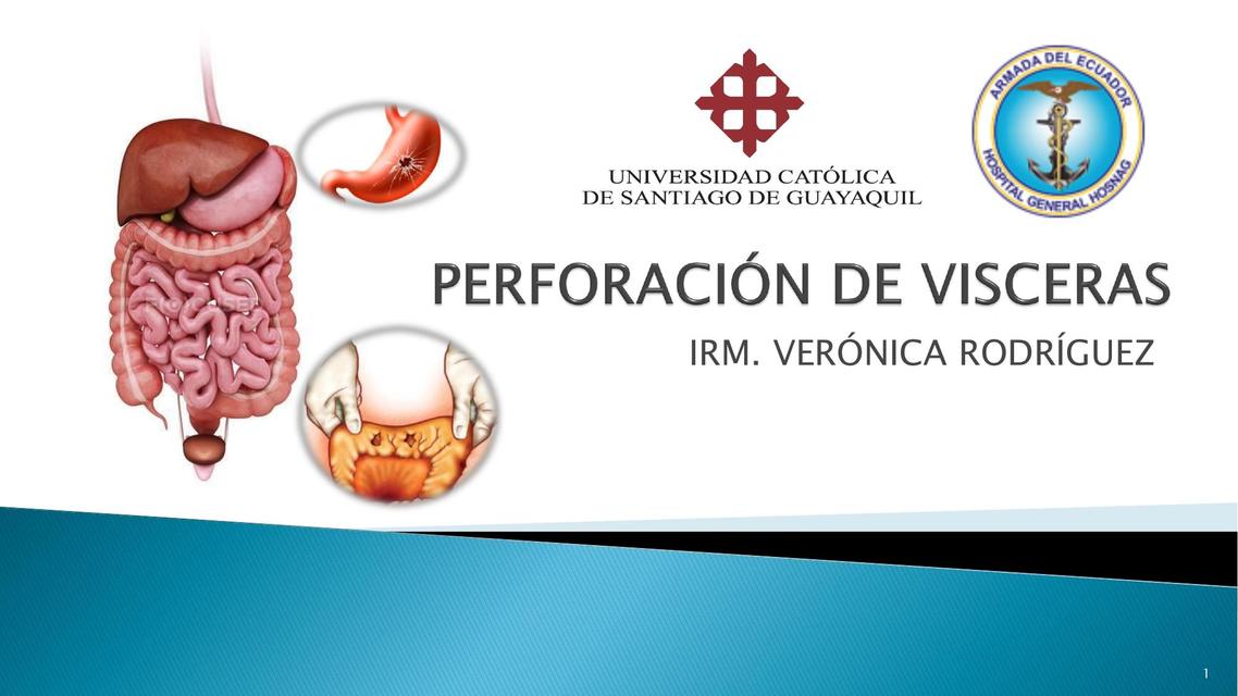 Perforación de Vísceras