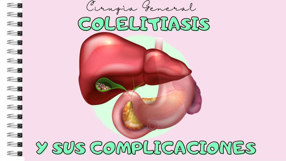 COLELITIASIS BY DRA ESTROGENO