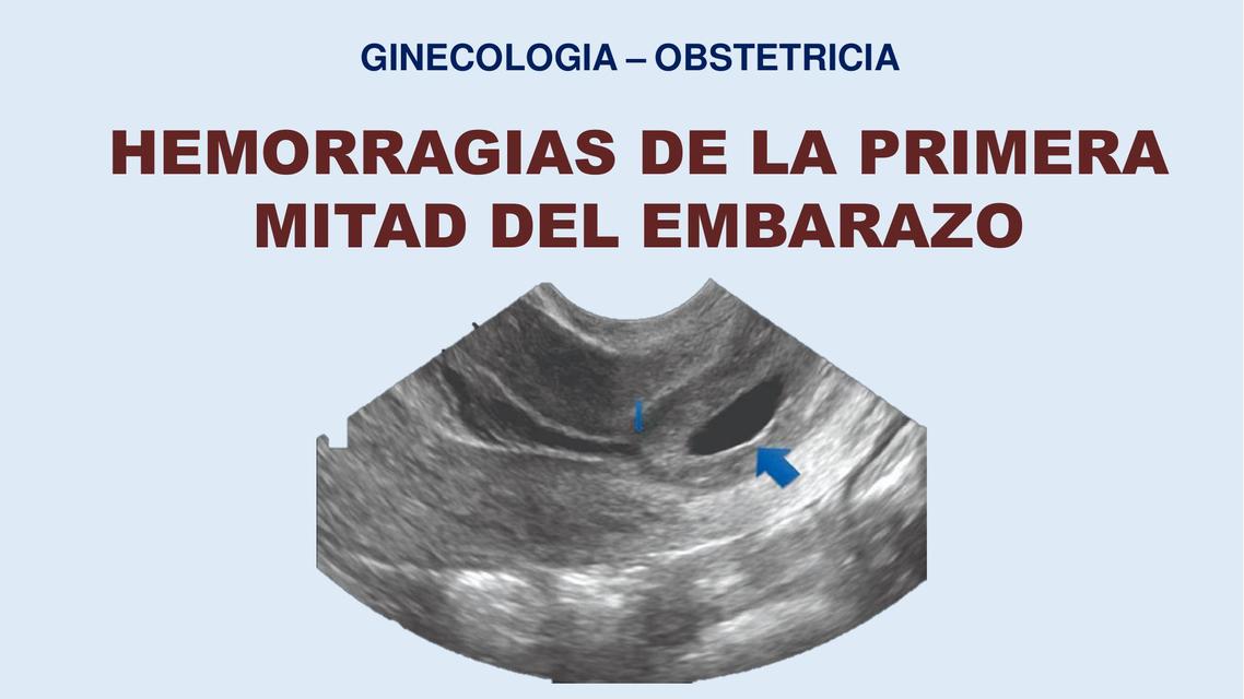 HEMORRAGIAS DE LA PRIMERA MITAD DEL EMBARAZO