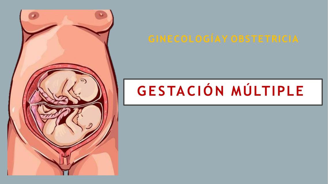 Gestacion Multiple Apuntes De Medicina Resumenes De Medicina Udocz