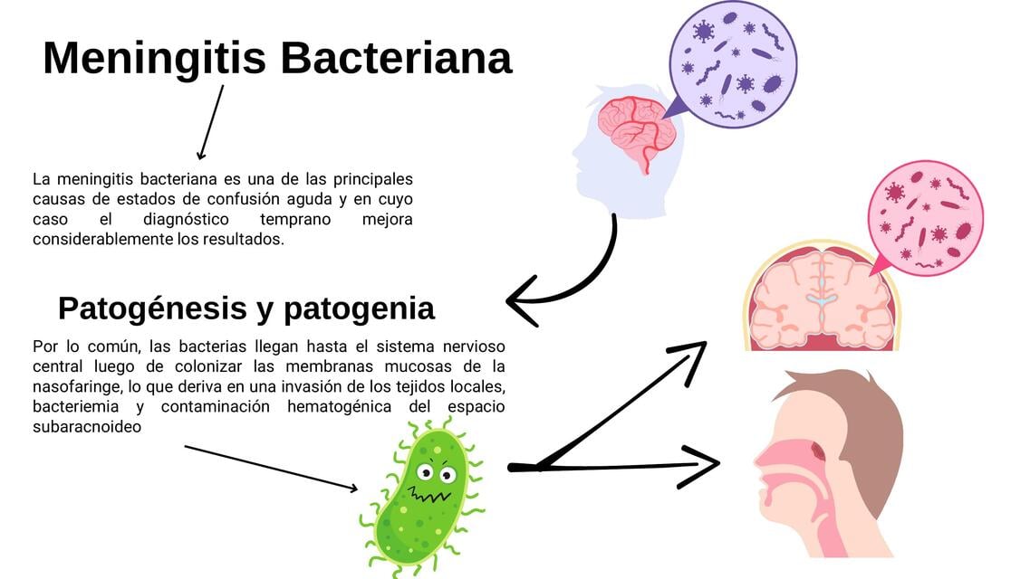 Flashcards de Meningitis Bacteriana | Por Escuela medica | uDocz
