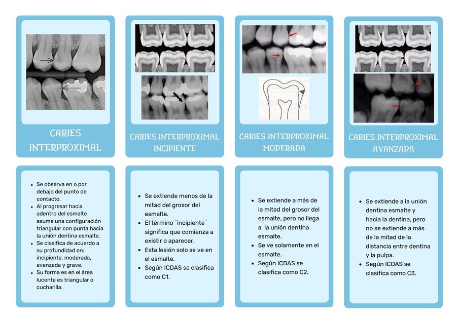 Caries Code R1 INTERPRETACION DE CARIES DENTAL | Ally De León | uDocz