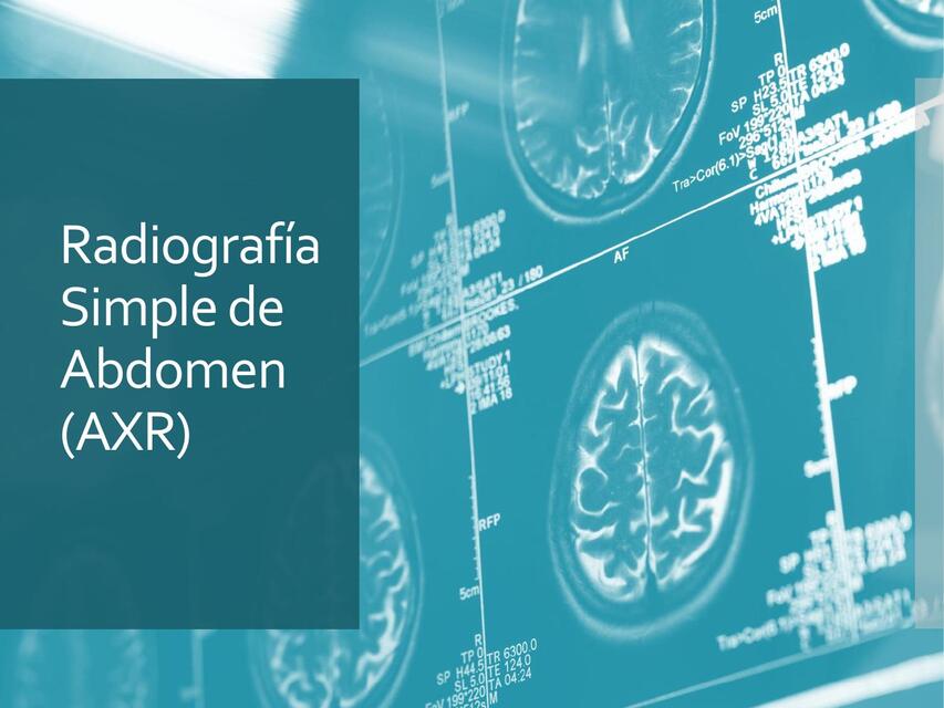Radiografía Simple de Abdomen AXR | Medicina Mundial | uDocz
