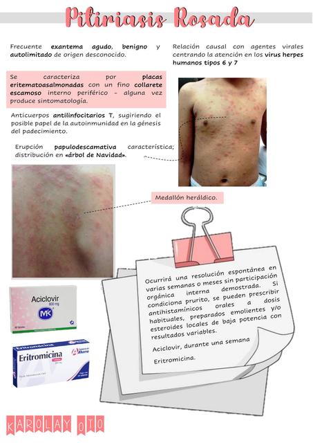 Pitiriasis Rosada