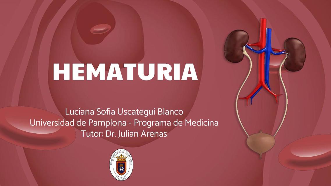 Hematuria 