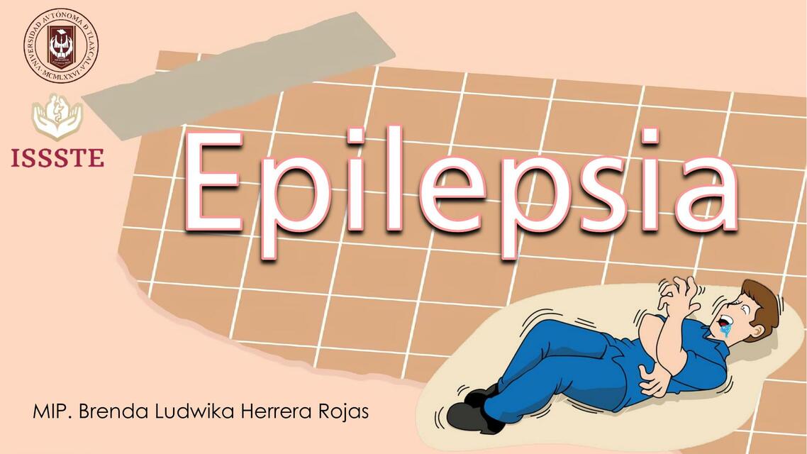 Epilepsia