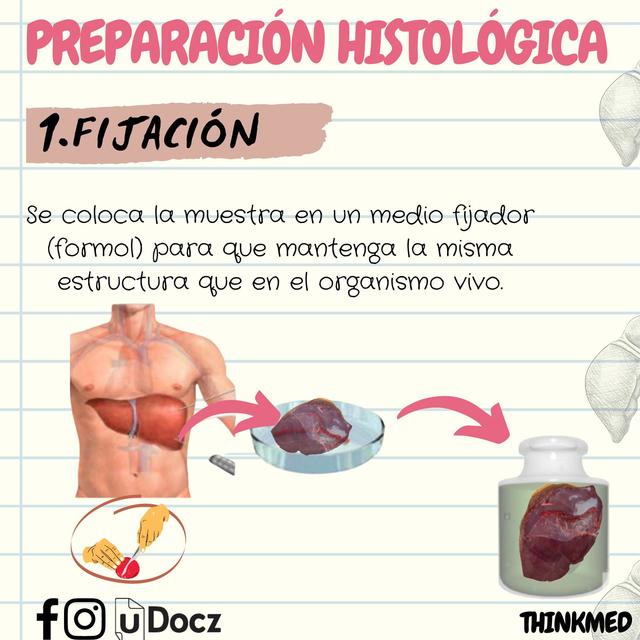 Preparación Histológica