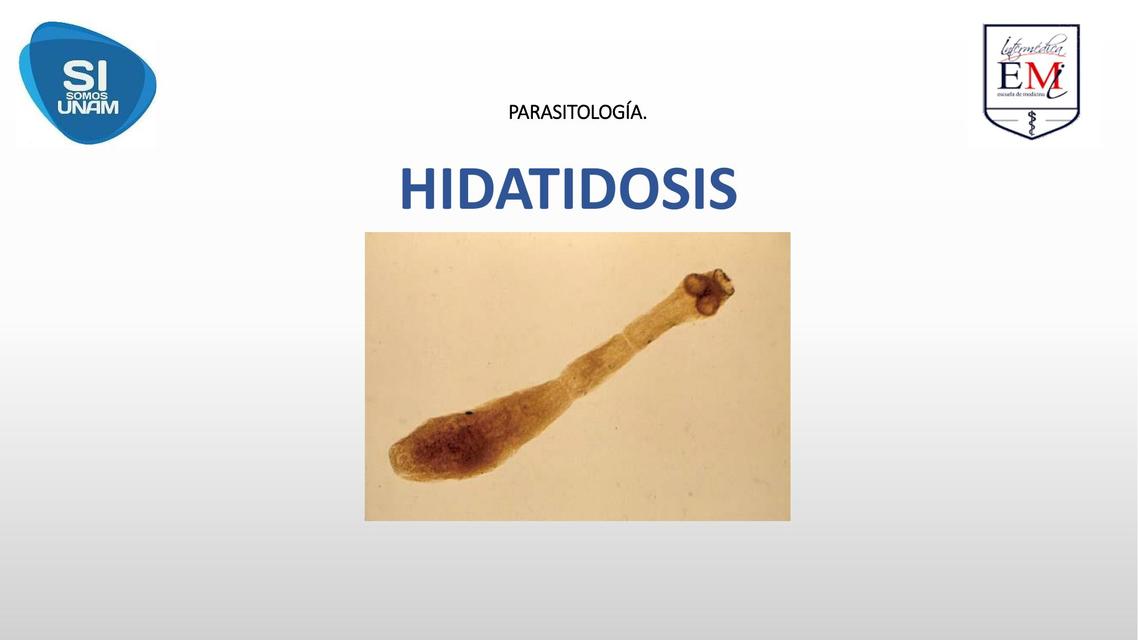 Hidatidosis