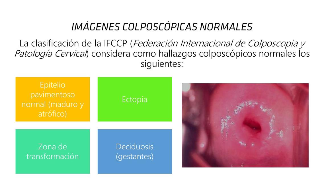 Imágenes Colposcopias Normales