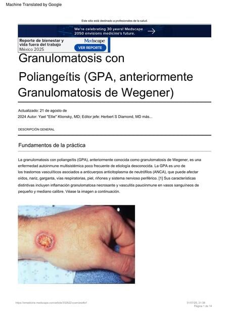 Granulomatosis with Polyangiitis GPA formerly Wege | Nick | uDocz
