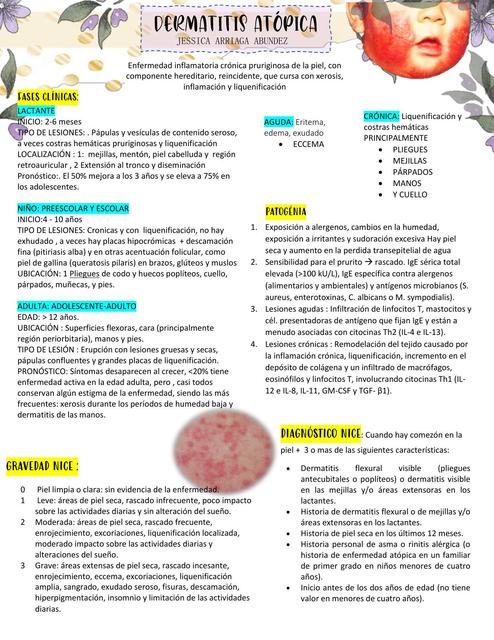 Dermatitis Atópica 