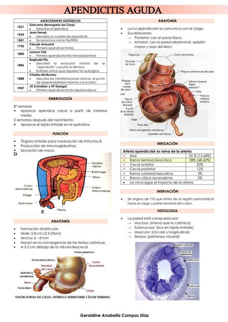 Apendicitis Aguda