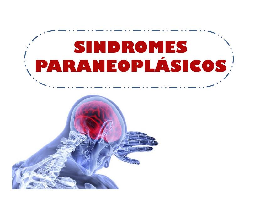 Síndromes Paraneoplásicos