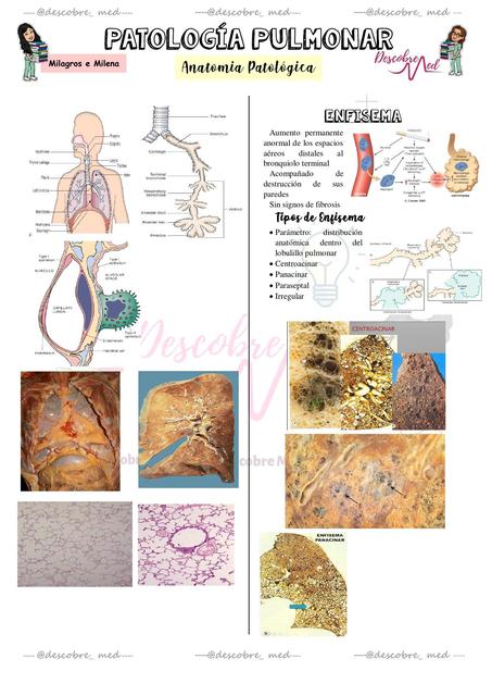 Patologías Pulmonares 