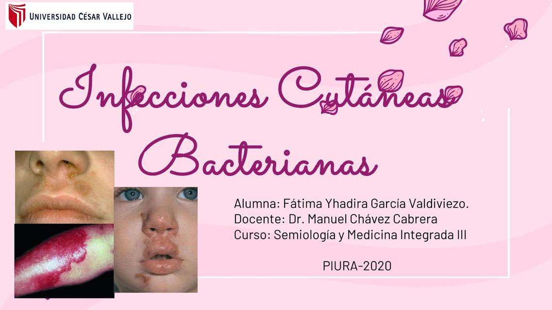 Infecciones Cutáneas Bacterianas