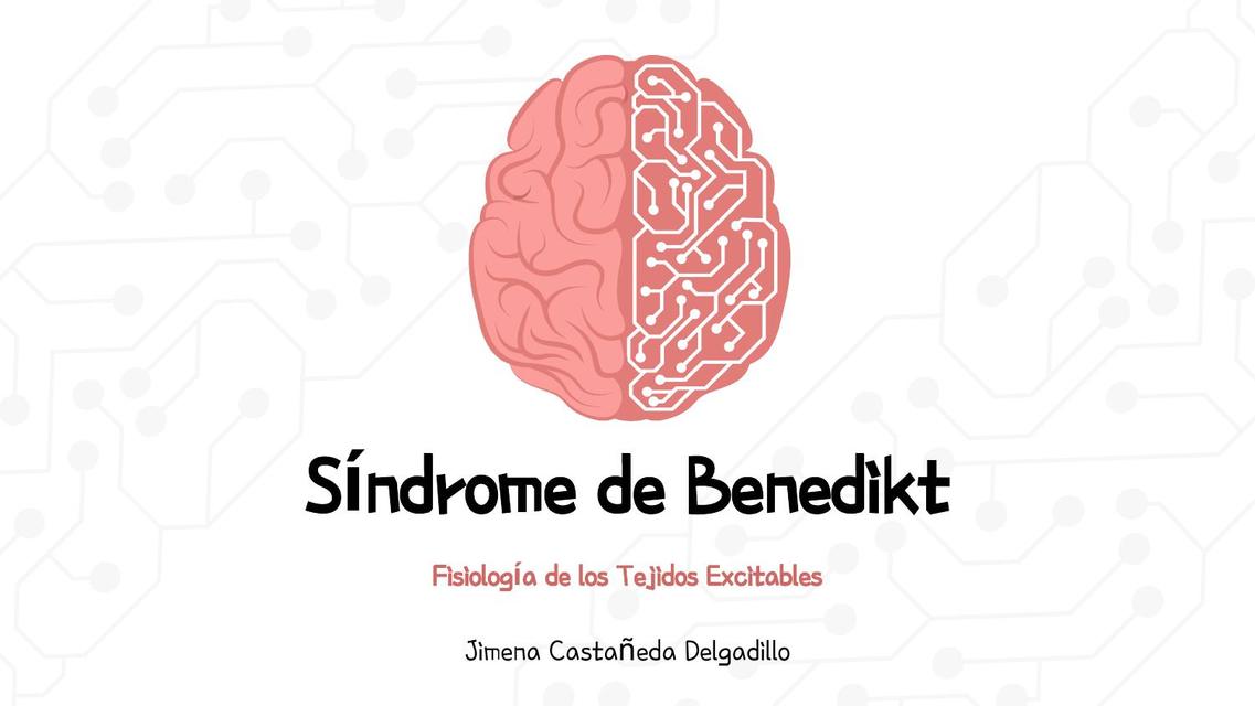 Síndrome de Benedikt